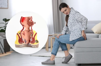 How Constipation Causes Piles & Best Natural Treatment in Pakistan